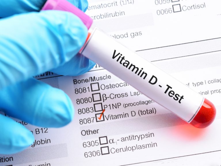 Read more about the article Unraveling the Hidden Benefits of Vitamin D: A Blood Test You Need Now!