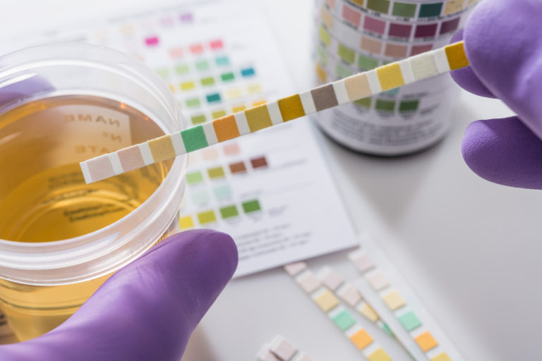 Read more about the article Urine Toxicology: Understanding the Power of Diagnostic Testing